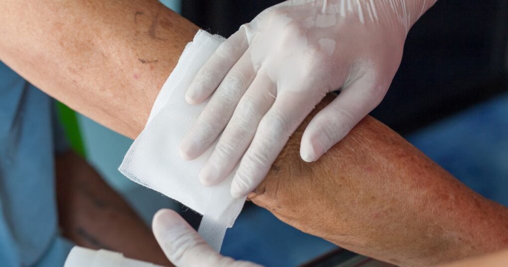Advanced Wound Care in Skilled Nursing